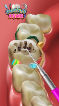 치과 진료실: 근관 시뮬레이션 게임 스크린샷