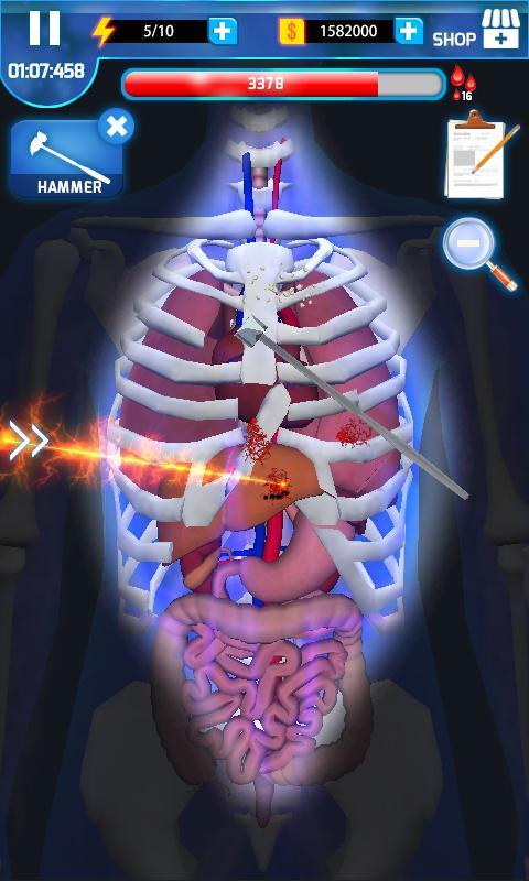 Cuplikan Layar Game Surgery Master