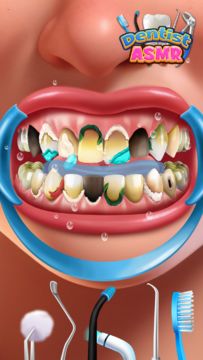 치과 진료실: 근관 시뮬레이션 게임 스크린샷