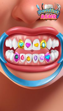 치과 진료실: 근관 시뮬레이션 게임 스크린샷