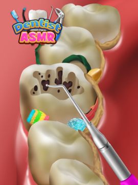 치과 진료실: 근관 시뮬레이션 게임 스크린샷