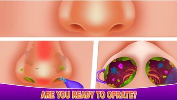 Ear Cleaning Games: EAR Doctor Game Screenshot