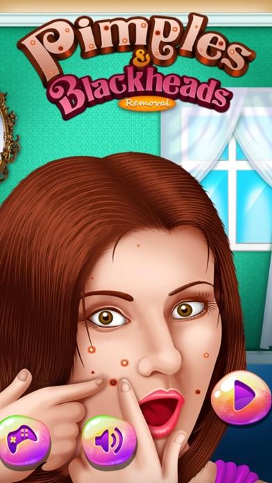 Pimples and Blackheads Removal : get rid of pimples from nose and face ! FREE Game Screenshot